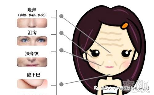 https://img.miyanlife.com/mnt/timg/170829/1149463114-13.jpg