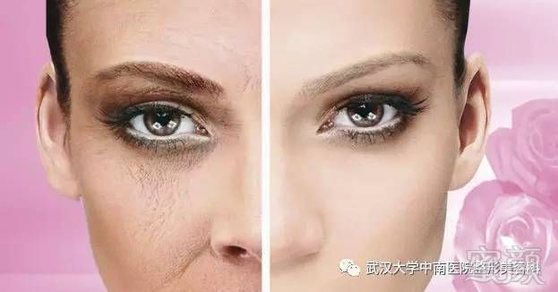 https://img.miyanlife.com/mnt/timg/170829/11494I5F-14.jpg