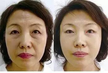 https://img.miyanlife.com/mnt/timg/170830/1445523C1-4.jpg