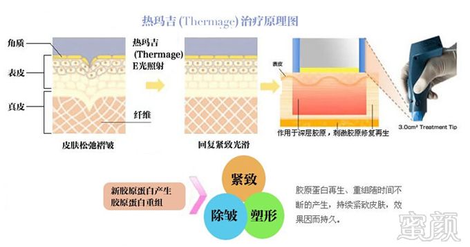 案例图片