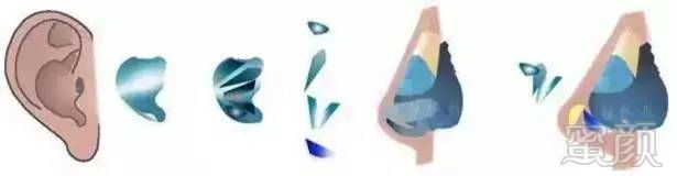 https://img.miyanlife.com/mnt/timg/170831/1151235Z1-4.jpg