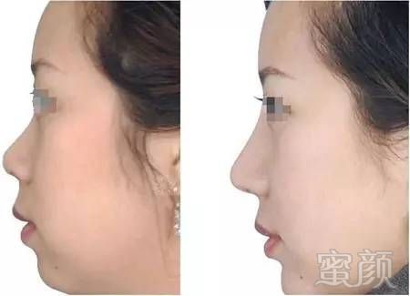 https://img.miyanlife.com/mnt/timg/170831/1151245647-6.jpg