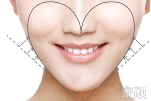 https://img.miyanlife.com/mnt/timg/170831/120R95H0-3.jpg