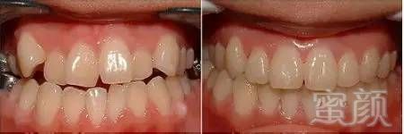 https://img.miyanlife.com/mnt/timg/170831/1343054501-5.jpg