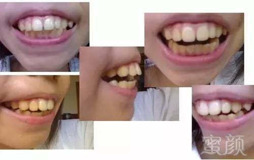 https://img.miyanlife.com/mnt/timg/170831/1343061137-7.jpg
