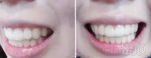 https://img.miyanlife.com/mnt/timg/170831/13430HM1-12.jpg