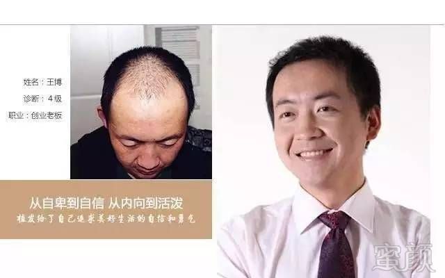 https://img.miyanlife.com/mnt/timg/170901/11245J416-4.jpg