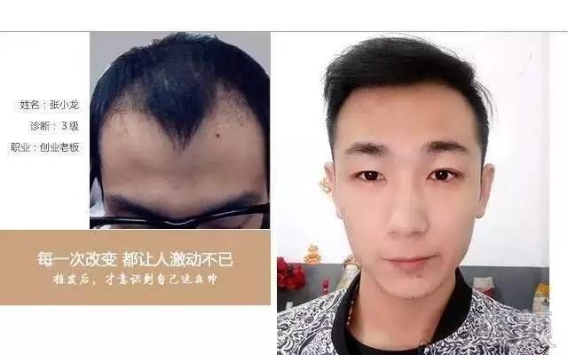 https://img.miyanlife.com/mnt/timg/170901/11245U295-6.jpg