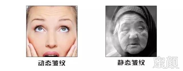 https://img.miyanlife.com/mnt/timg/170901/11322524K-3.jpg