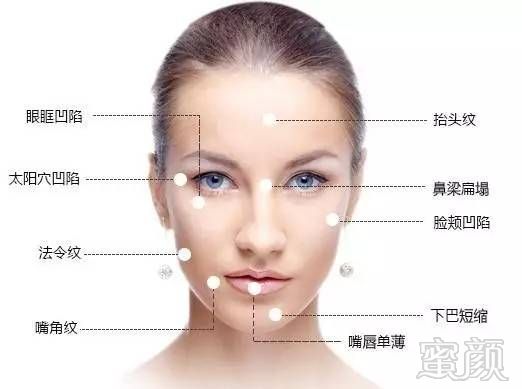 https://img.miyanlife.com/mnt/timg/170901/11322J641-8.jpg