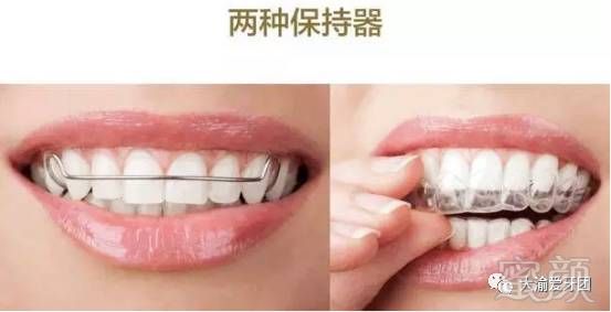 https://img.miyanlife.com/mnt/timg/170901/1254515103-0.jpg