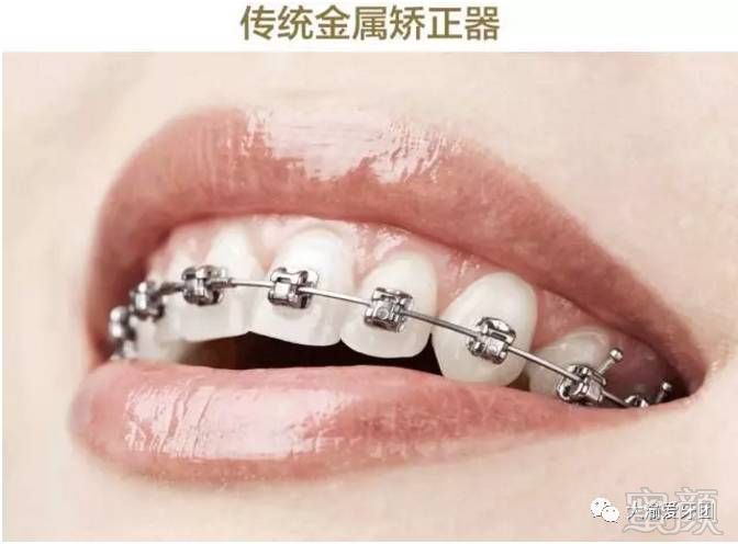 https://img.miyanlife.com/mnt/timg/170901/1254523K1-1.jpg