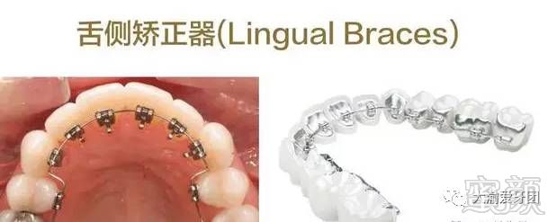 https://img.miyanlife.com/mnt/timg/170901/1254524139-4.jpg