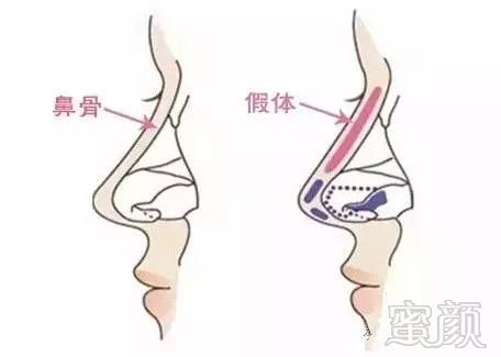 https://img.miyanlife.com/mnt/timg/170901/13191615M-2.jpg