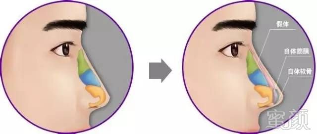 https://img.miyanlife.com/mnt/timg/170901/1319195529-8.jpg