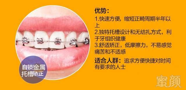 https://img.miyanlife.com/mnt/timg/170902/20463GT0-5.jpg