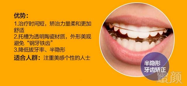 https://img.miyanlife.com/mnt/timg/170902/20463K232-6.jpg