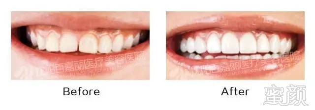 https://img.miyanlife.com/mnt/timg/170902/20463UK7-9.jpg