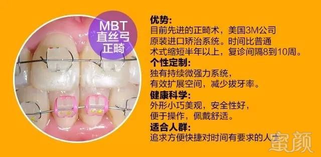 https://img.miyanlife.com/mnt/timg/170902/20463V151-7.jpg