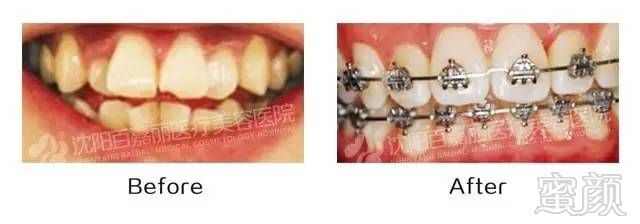 https://img.miyanlife.com/mnt/timg/170902/20463W023-8.jpg