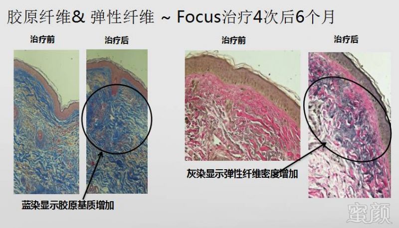 案例图片