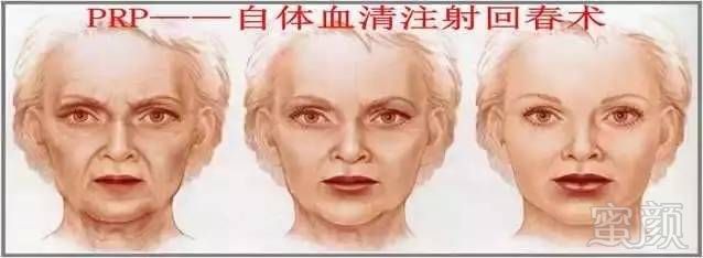 https://img.miyanlife.com/mnt/timg/170902/2104391111-0.jpg