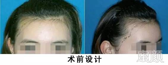 https://img.miyanlife.com/mnt/timg/170902/2339111C8-6.jpg