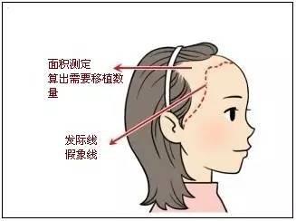 https://img.miyanlife.com/mnt/timg/170902/23391123T-3.jpg