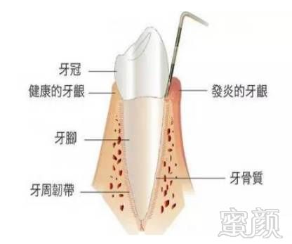 案例图片