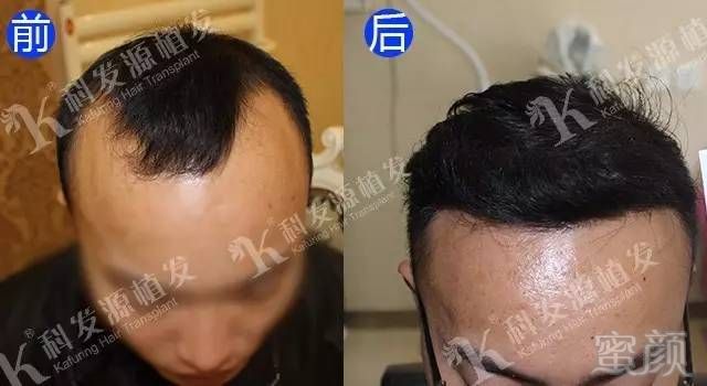 https://img.miyanlife.com/mnt/timg/170903/13093LX1-0.jpg
