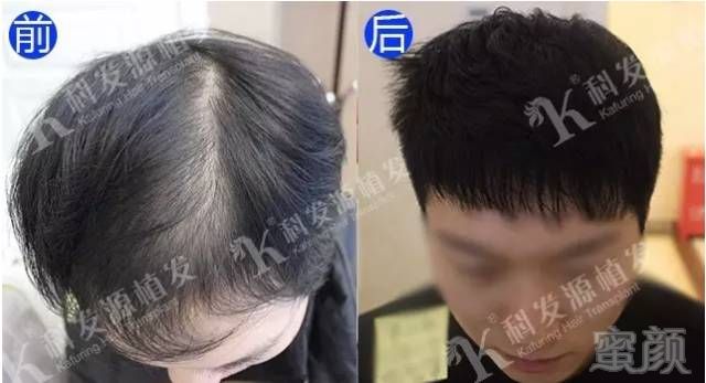 https://img.miyanlife.com/mnt/timg/170903/1309425358-14.jpg