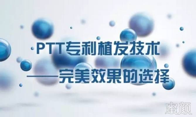 https://img.miyanlife.com/mnt/timg/170903/150GG350-3.jpg