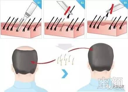 https://img.miyanlife.com/mnt/timg/170903/151J51Z1-1.jpg