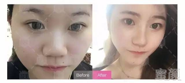 https://img.miyanlife.com/mnt/timg/170905/115U21357-9.jpg