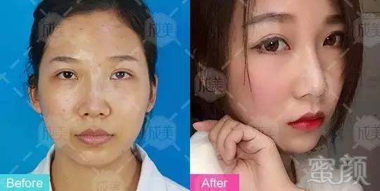 https://img.miyanlife.com/mnt/timg/170905/115U3D39-12.jpg
