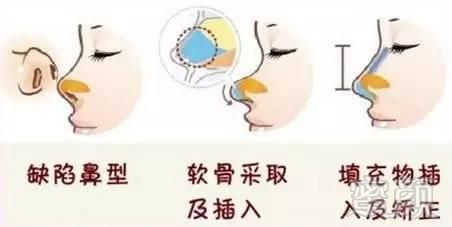 https://img.miyanlife.com/mnt/timg/170906/11521262b-3.jpg