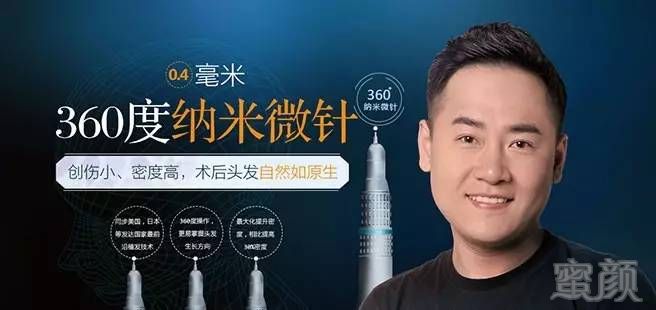 https://img.miyanlife.com/mnt/timg/170906/12253Q594-1.jpg