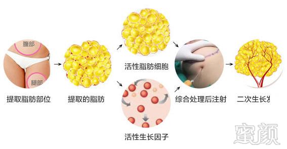 https://img.miyanlife.com/mnt/timg/170906/1300435E3-0-j.jpg