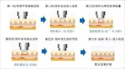 案例图片