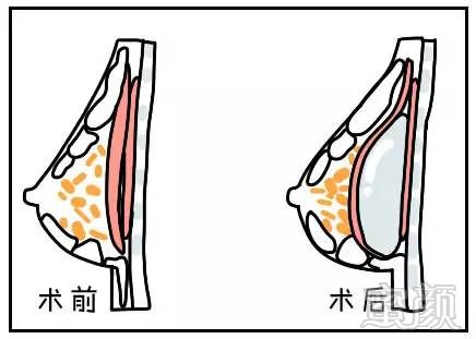 案例图片