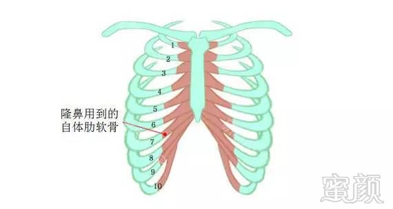https://img.miyanlife.com/mnt/timg/170910/1243055C0-5.jpg
