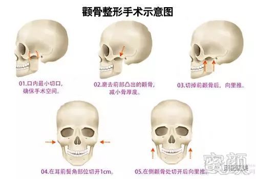 案例图片