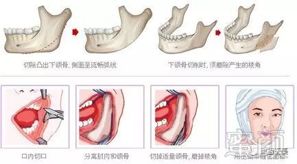 案例图片