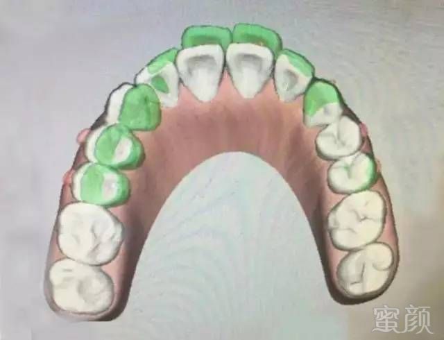 https://img.miyanlife.com/mnt/timg/170911/104250K51-1.jpg