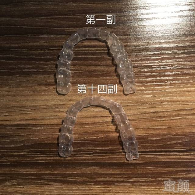 https://img.miyanlife.com/mnt/timg/170911/1042515F6-6.jpg