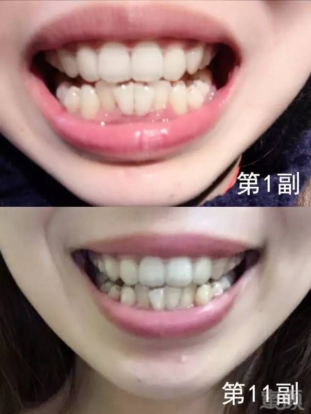 https://img.miyanlife.com/mnt/timg/170911/104252K94-9.jpg