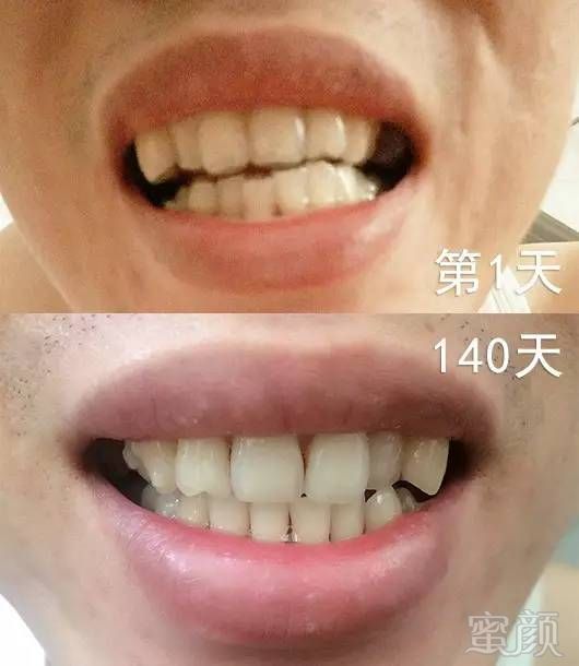 https://img.miyanlife.com/mnt/timg/170911/1042541G6-14.jpg