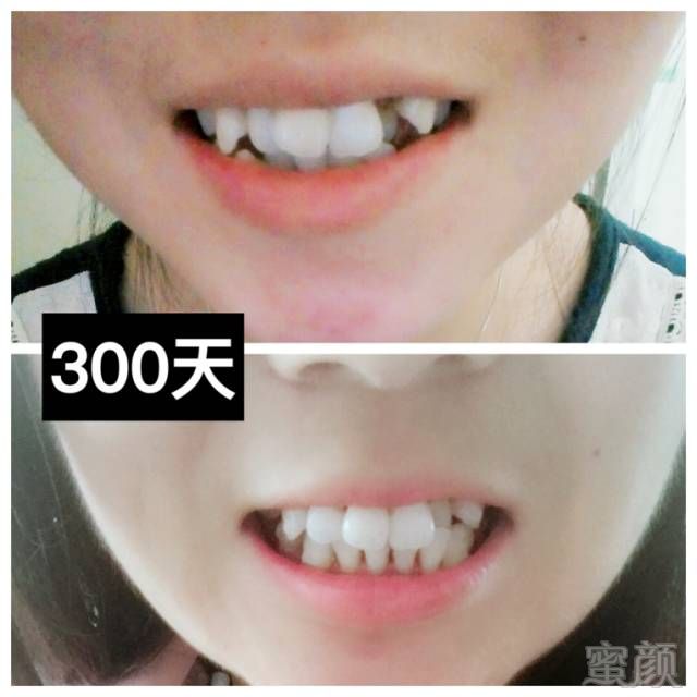 https://img.miyanlife.com/mnt/timg/170911/10425442U-13.jpg