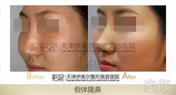 https://img.miyanlife.com/mnt/timg/170911/105I61329-1.jpg