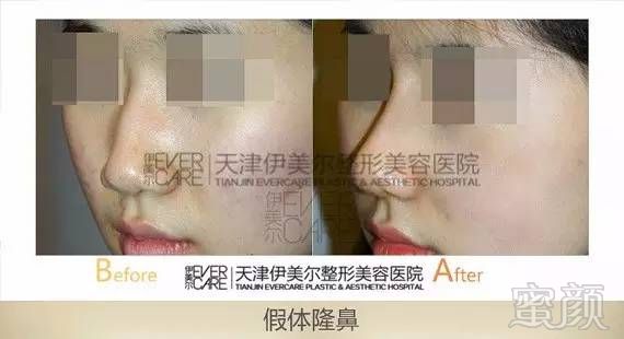 https://img.miyanlife.com/mnt/timg/170911/105I63364-0.jpg